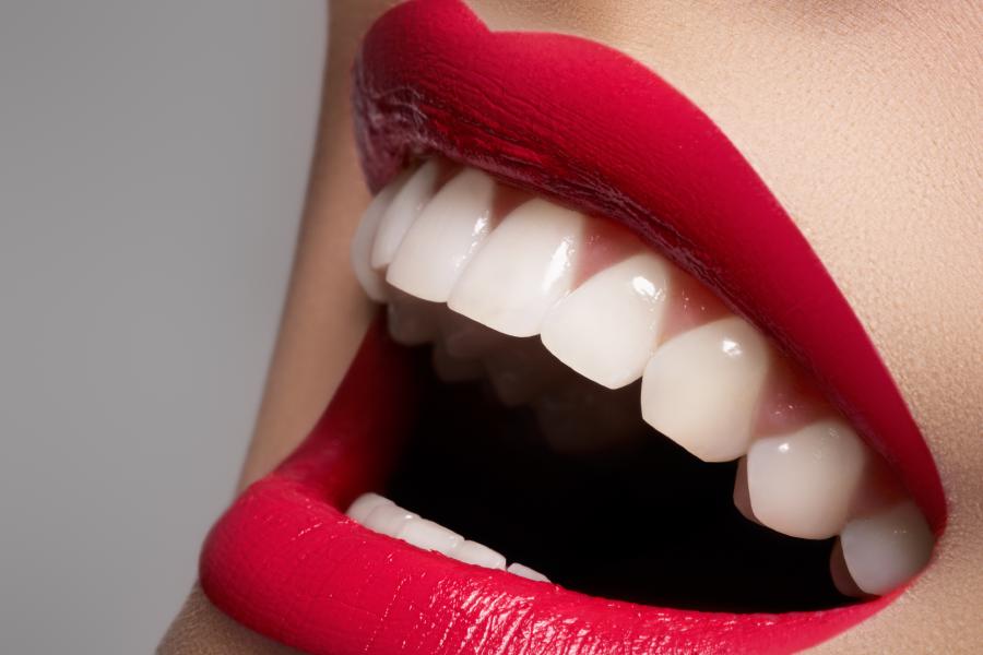 Image of Teeth Whitening